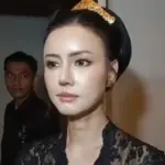 Nita Gunawan Habiskan Ratusan Juta Operasi Rekonstruksi Wajah di Shanghai